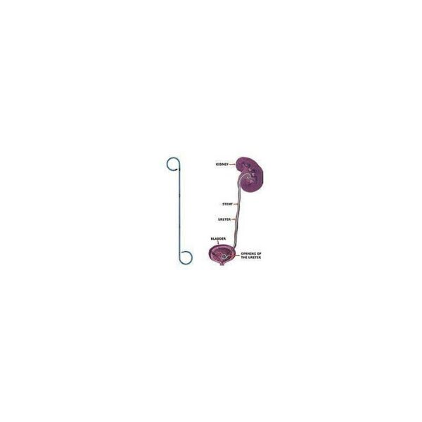 SONDE JJ URETERAL
